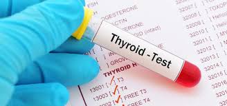 How to Prepare for a Thyroid Test 