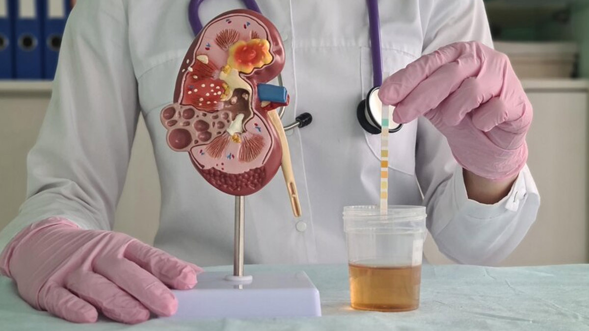 Burn No More, Darling: The UTI  Prevention Playbook You Deserve